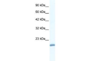 WB Suggested Anti-EDF1 Antibody Titration:  1. (EDF1 抗体  (N-Term))