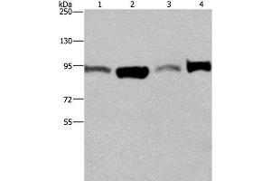 Western Blot analysis of A375 and LoVo cell, Human testis tissue and Hela cell using ELAC2 Polyclonal Antibody at dilution of 1:250 (ELAC2 抗体)