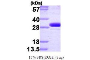 Figure annotation denotes ug of protein loaded and % gel used. (CA2 Protein (AA 1-260))