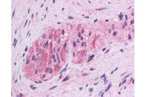 WNT5A antibody was used for immunohistochemistry at a concentration of 4-8 ug/ml. (WNT5A 抗体  (Middle Region))