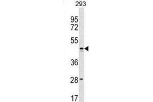 Western Blotting (WB) image for anti-Family with Sequence Similarity 155, Member B (FAM155B) antibody (ABIN3000232) (FAM155B 抗体)
