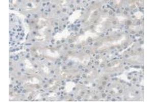 Detection of CES1 in Rat Kidney Tissue using Polyclonal Antibody to Carboxylesterase 1 (CES1) (CES1 抗体  (AA 19-300))