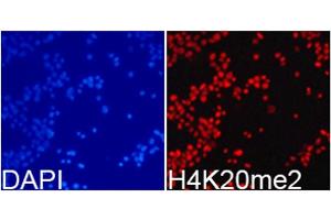 Immunofluorescence analysis of 293T cells using DiMethyl-Histone H4-K20 antibody. (Histone H4 抗体  (2meLys20))