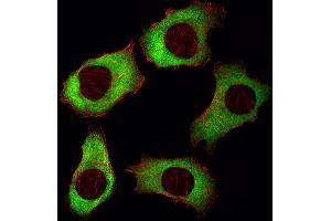 Fluorescent image of A549 cell stained with YBX1 Antibody . (YBX1 抗体  (AA 149-178))