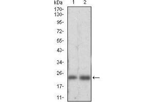 Western Blotting (WB) image for anti-Ferritin, Light Polypeptide (FTL) (AA 1-175) antibody (ABIN2682991)