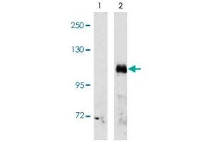 Western blot analysis of EPHA3 (arrow) using EPHA3 polyclonal antibody . (EPH Receptor A3 抗体  (C-Term))