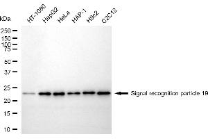 anti-Signal Recognition Particle 19kDa (SRP19) antibody