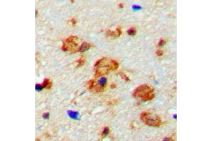 Immunohistochemical analysis of CaMK2 beta/gamma (pT287) staining in human brain formalin fixed paraffin embedded tissue section. (CaMK2 beta/gamma 抗体  (pSer287))