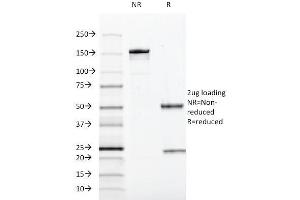 SDS-PAGE (SDS) image for anti-SRY (Sex Determining Region Y)-Box 10 (SOX10) (AA 115-269) antibody (ABIN6940623)
