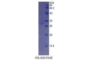 SDS-PAGE (SDS) image for ATP-Binding Cassette, Sub-Family A (ABC1), Member 1 (ABCA1) (AA 1404-1663) protein (His tag) (ABIN1879478)