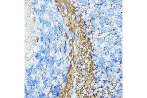 Immunohistochemistry of paraffin-embedded mouse brain using Neurofilament M Rabbit pAb (ABIN7268865) at dilution of 1:100 (40x lens). (NEFM 抗体  (AA 200-300))