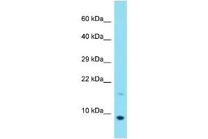 Host: Rabbit Target Name: C20orf166 Sample Type: MCF7 Whole Cell lysates Antibody Dilution: 1. (C20orf166 抗体  (C-Term))