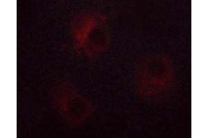 ABIN6267378 staining RL cells by ICC/IF. (NCF1 抗体  (pSer359))