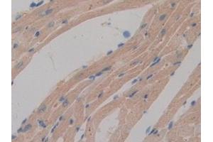Detection of DAPP1 in Mouse Heart Tissue using Polyclonal Antibody to Dual Adaptor Of Phosphotyrosine And 3-Phosphoinositides (DAPP1)