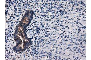 Image no. 11 for anti-ADP-Ribosylation Factor GTPase Activating Protein 1 (ARFGAP1) antibody (ABIN1496679)