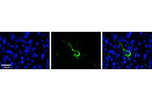 Rabbit Anti-LPIN1 Antibody  Catalog Number: ARP53826_P050  Formalin Fixed Paraffin Embedded Tissue: Human Pineal Tissue  Observed Staining: Cytoplasmic and membrane in cell bodies and processes of pinealocytes  Primary Antibody Concentration: 1:100  Other Working Concentrations: 1/600  Secondary Antibody: Donkey anti-Rabbit-Cy3  Secondary Antibody Concentration: 1:200  Magnification: 20X  Exposure Time: 0. (Lipin 1 抗体  (N-Term))