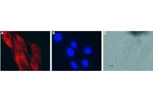 Expression of CNTF in rat C6 glioma cells - Immunocytochemical staining of fixed and permeabilized rat C6 glioma cells. (CNTF 抗体  (AA 164-177))