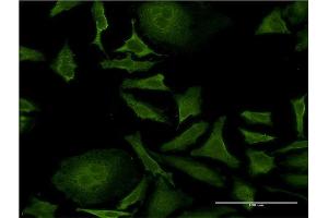 Immunofluorescence of monoclonal antibody to ISCU on HeLa cell. (ISCU 抗体  (AA 26-167))