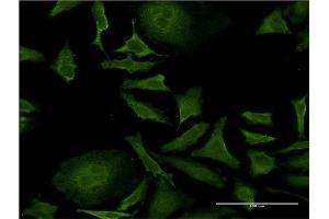 Immunofluorescence of monoclonal antibody to ISCU on HeLa cell. (ISCU 抗体  (AA 26-167))