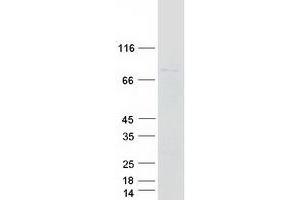 Western Blotting (WB) image for Ecdysoneless Homolog (ECD) (Transcript Variant 1) protein (Myc-DYKDDDDK Tag) (ABIN2723078)