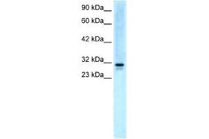 Human HepG2; WB Suggested Anti-EAP30 Antibody Titration: 5. (SNF8 抗体  (N-Term))