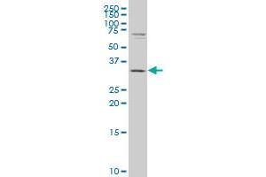 CBR3 polyclonal antibody (A01), Lot # 060124JC01. (CBR3 抗体  (AA 180-277))