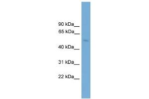 WB Suggested Anti-BBS4 Antibody Titration: 0. (BBS4 抗体  (Middle Region))