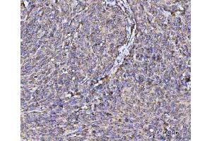 IHC analysis of RPL36 using anti-RPL36 antibody (ABIN7602917).