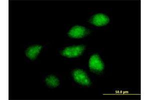 Immunofluorescence of purified MaxPab antibody to ARFIP2 on HeLa cell. (ARFIP2 抗体  (AA 1-341))