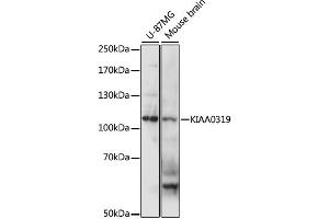 Western blot analysis of extracts of various cell lines, using KIAA0319 antibody (ABIN6290542) at 1:1000 dilution. (KIAA0319 抗体)