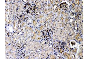 DR5 was detected in paraffin-embedded sections of rat kidney tissues using rabbit anti- DR5 Antigen Affinity purified polyclonal antibody (Catalog # ) at 1 µg/mL. (TNFRSF10B 抗体  (AA 233-440))