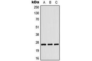 Western blot analysis of Tumstatin expression in HepG2 colchicine-treated (A), HeLa UV-treated (B), Raw264. (COL4a3 抗体  (C-Term))