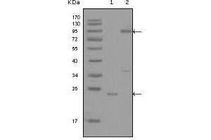 Western blot analysis using YES1 mouse mAb against truncated YES1-His recombinant protein (1) and full-length GFP-YES1(aa1-543) transfected COS7 cell lysate (2). (YES1 抗体  (AA 10-193))