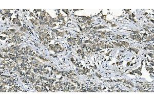 IHC analysis of EEF2/Elongation factor 2 using anti-EEF2/Elongation factor 2 antibody (ABIN7603142).