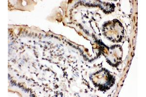 Immunohistochemistry (Paraffin-embedded Sections) (IHC (p)) image for anti-FBJ Murine Osteosarcoma Viral Oncogene Homolog B (FOSB) (AA 264-291), (C-Term) antibody (ABIN3042399) (FOSB 抗体  (C-Term))