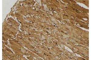 ABIN6274735 at 1/100 staining Mouse muscle tissue by IHC-P. (MRPL21 抗体  (Internal Region))
