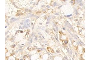 Immunohistochemistry (IHC) image for anti-Keratin 10 (KRT10) (AA 153-456) antibody (ABIN7433948)