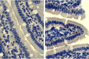 Paraffin embedded mouse small intestine section was stained with Rat Anti-Mouse IgD-UNLB followed by an HRP conjugated secondary antibody, DAB, and hematoxylin. (大鼠 anti-小鼠 IgD Antibody)