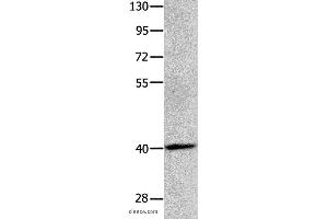 Western blot analysis of Human brain glioma tissue, using MAGEB4 Polyclonal Antibody at dilution of 1:550 (MAGEB4 抗体)