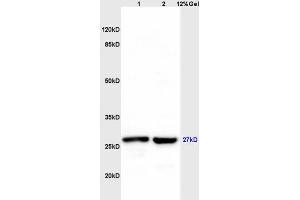 Lane 1: mouse liver lysates Lane 2: mouse brain lysates probed with Anti MS4A2 Polyclonal Antibody, Unconjugated (ABIN1715142) at 1:200 in 4 °C. (MS4A2 抗体  (AA 51-150))