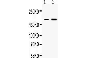Western blot analysis of CSB expression in rat liver extract ( Lane 1) and COLO320 whole cell lysates ( Lane 2). (ERCC6 抗体  (N-Term))