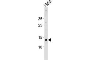 Western Blotting (WB) image for anti-Death-Associated Protein (DAP) antibody (ABIN3004644) (DAP 抗体)