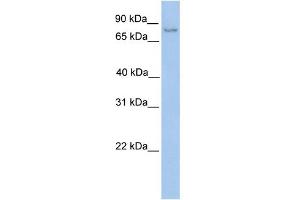WB Suggested Anti-NSUN2 Antibody Titration:  0. (NSUN2 抗体  (C-Term))