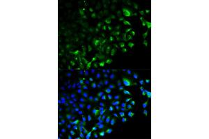 Immunofluorescence analysis of HeLa cells using TRAF2 antibody (ABIN5970352). (TRAF2 抗体)