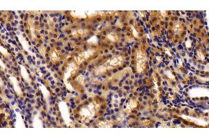 Detection of OLFM4 in Rat Kidney Tissue using Polyclonal Antibody to Olfactomedin 4 (OLFM4) (Olfactomedin 4 抗体  (AA 405-511))