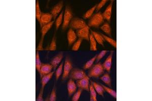 Immunofluorescence (IF) image for anti-Laminin, beta 1 (LAMB1) antibody (ABIN7268185)