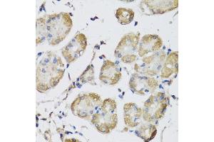 Immunohistochemistry of paraffin-embedded human stomach using USH1C antibody (ABIN5972448) at dilution of 1/100 (40x lens). (USH1C 抗体)