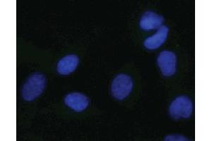 Immunofluorescent staining of HeLa cells. (MAPK14 抗体  (pThr180))