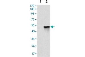 Western blot analysis using TNNI2 monoclonal antobody, clone 2F12G2  against HEK293 (1) and TNNI2 (aa1-182)-hIgGFc transfected HEK293 (2) cell lysate. (TNNI2 抗体)