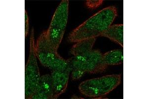 Immunofluorescent staining of RH-30 cell line with antibody shows positivity in nucleoplasm and the Golgi apparatus (green).